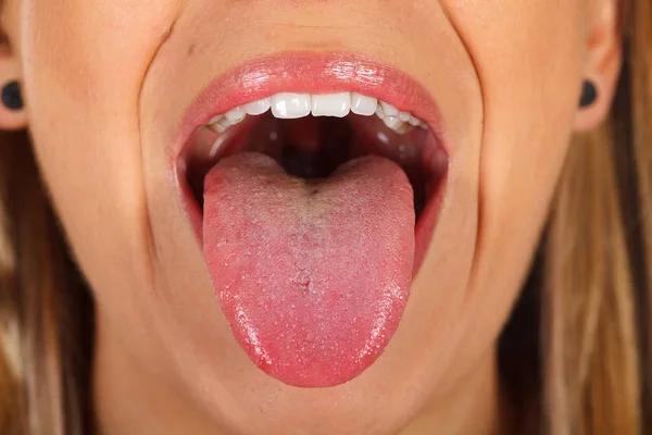 What a Healthy Tongue Should Look Like
